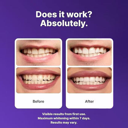 Juxek™ New 2nd Generation Purple Teeth Whitening Strips（2）