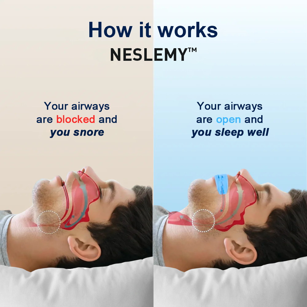 NESLEMY™  Professional intelligent anti-snoring device（2）